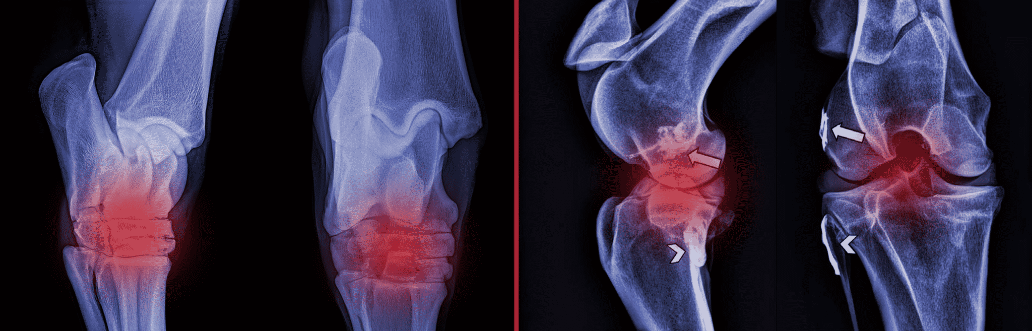 Nutrtional Support for Hock & Stifle Problems in Horses