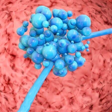 leaky gut syndrome leaky gut syndrome