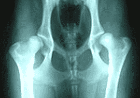 Hip Dysplasia in Dogs – Overview