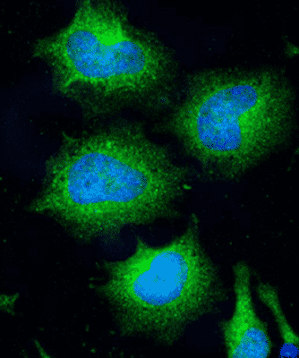 horse-Stx17-gene-anitbody Stx17 Gene Antibody