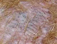 demodetic_mange demodetic mange picture