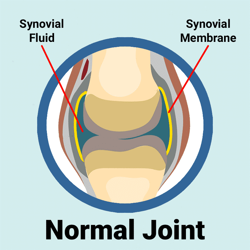 normal-synovial-joint Normal Synovial Joint